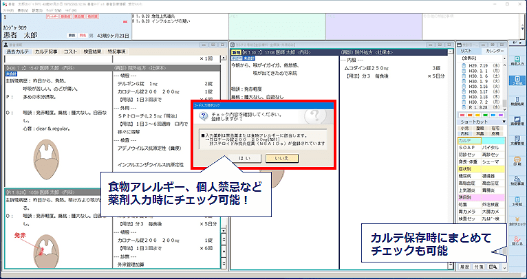 薬剤チェック